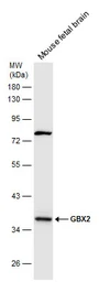 Anti-GBX2 antibody used in Western Blot (WB). GTX129494
